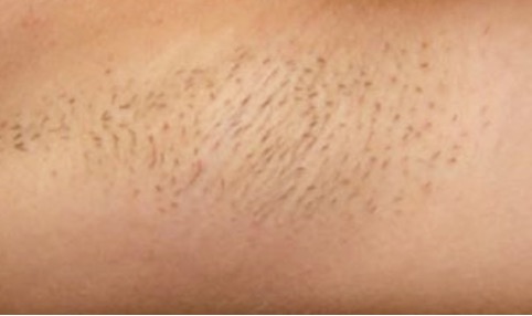Close up of woman's armpit with stubble.