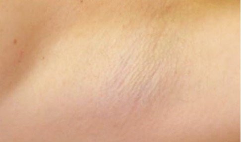 Close up of woman's armpit with no stubble.